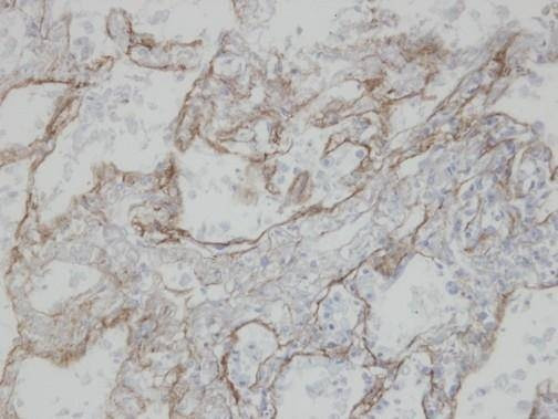 Anti-CLIC3 Antibody
