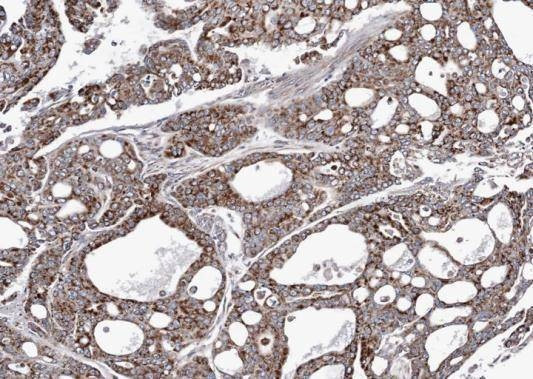 Anti-Adenylate kinase 3 Antibody