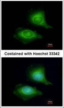 Anti-LZTFL1 Antibody
