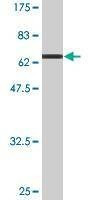 Anti-AHCY Antibody