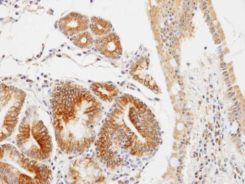 Anti-GLOD4 Antibody