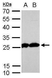 Anti-Triosephosphate isomerase (C-term) Antibody