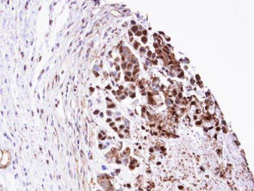 Anti-Triosephosphate isomerase (C-term) Antibody