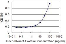 Anti-UPB1 Antibody