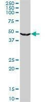 Anti-UPB1 Antibody