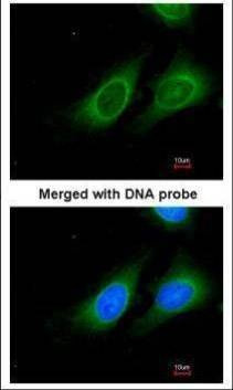 Anti-15-PGDH (C-term) Antibody