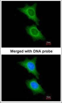 Anti-HSD11B1 Antibody
