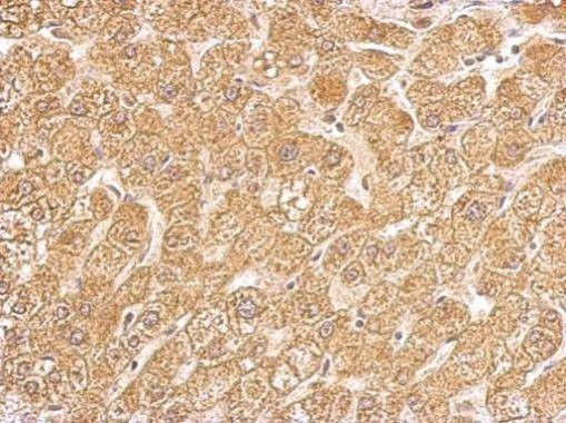 Anti-HSD11B1 Antibody