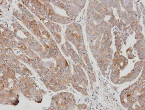 Anti-USP15 (C-term) Antibody