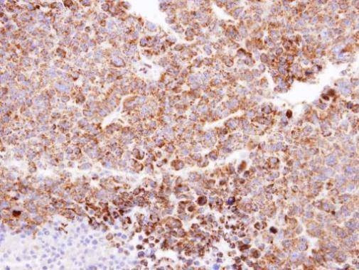 Anti-CLPP (C-term) Antibody