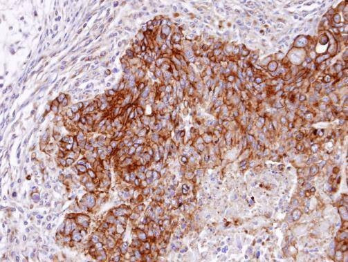 Anti-RASGRP4 (N-term) Antibody