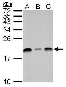 Anti-UBE2L3 Antibody