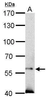 Anti-SOCS5 Antibody