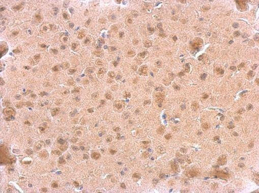 Anti-ARF3 Antibody