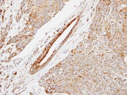 Anti-HSP22 (C-term) Antibody