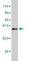 Anti-USF1 Antibody