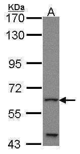 Anti-GLIS1 (C-term) Antibody