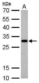 Anti-CTDSP2 Antibody