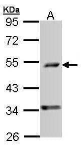 Anti-PDSS2 Antibody