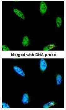 Anti-IPMK Antibody
