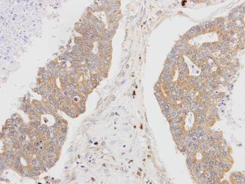 Anti-MSTO1 Antibody
