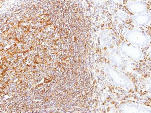 Anti-LBP Antibody