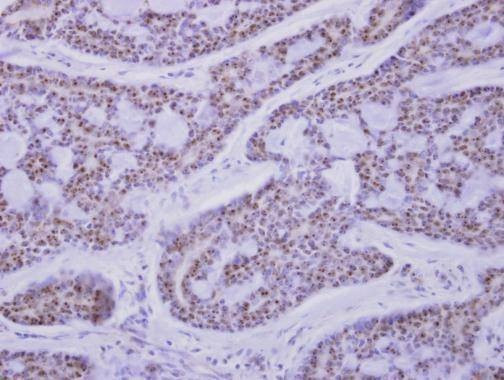 Anti-CaMK1D Antibody