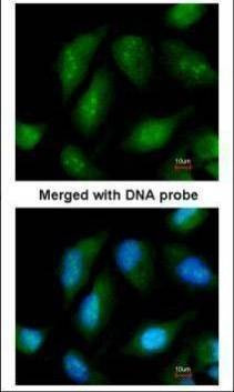Anti-NR0B1 Antibody