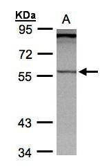 Anti-PCCB Antibody