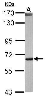 Anti-CROT (internal) Antibody