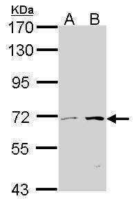 Anti-CROT (internal) Antibody