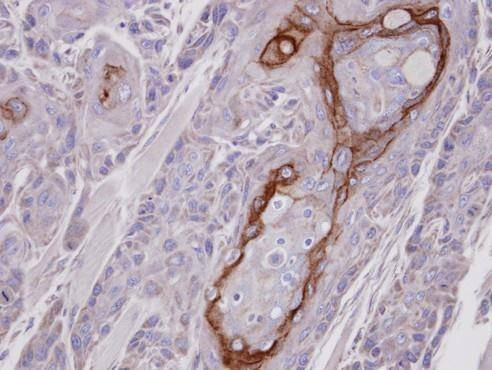 Anti-CROT (internal) Antibody