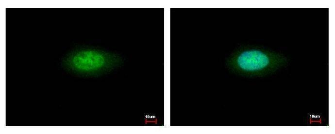 Anti-Annexin VII Antibody