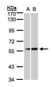 Anti-C1 inhibitor Antibody