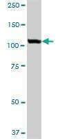 Anti-USO1 Antibody