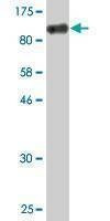 Anti-USO1 Antibody