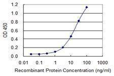 Anti-USO1 Antibody