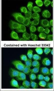 Anti-Complement C2 Antibody