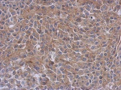 Anti-Radixin Antibody