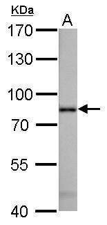 Anti-Radixin Antibody