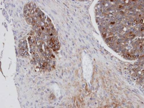 Anti-Mesothelin Antibody