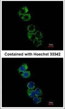 Anti-GSTA2 Antibody