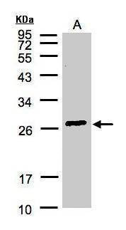 Anti-GSTA2 Antibody