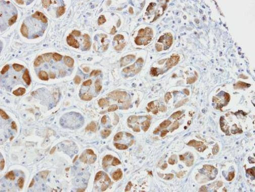 Anti-GSTA2 Antibody