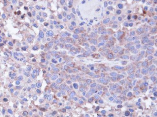 Anti-PP1C gamma Antibody
