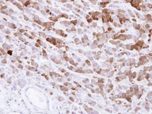 Anti-AKR1C1 Antibody