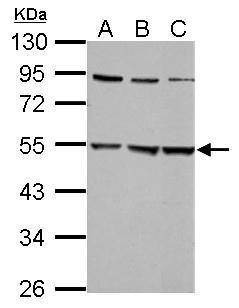 Anti-Glycine Receptor alpha 2 Antibody