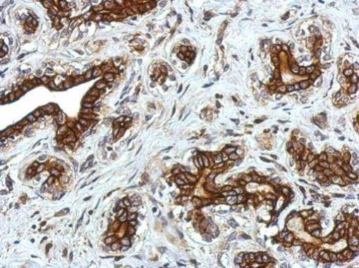 Anti-Glycine Receptor alpha 2 Antibody
