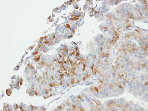 Anti-GSTO1 Antibody