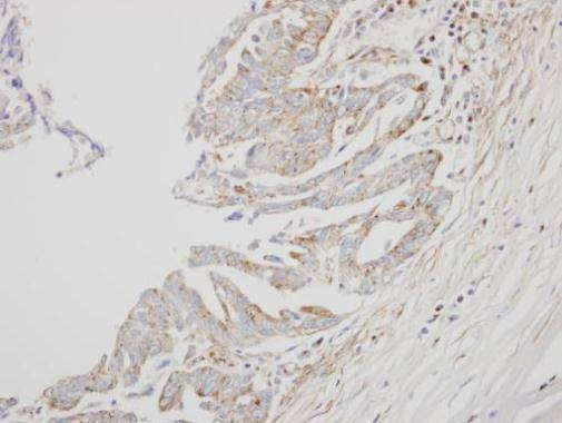 Anti-interferon alpha 8 Antibody
